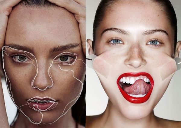Вместо пластики: 5 альтернативных процедур у косметолога